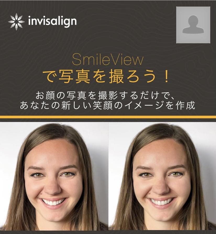 矯正後のお顔がイメージできます☆彡〜スマイルビューについてご紹介〜