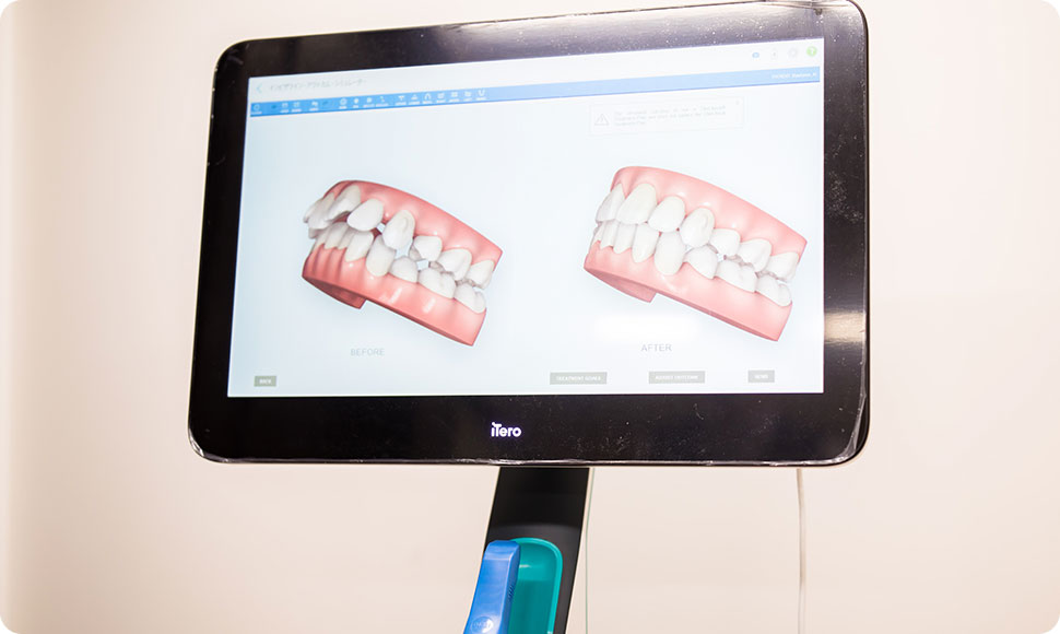 多様な臨床データに基づくシミュレーションで、より確実な矯正ができる