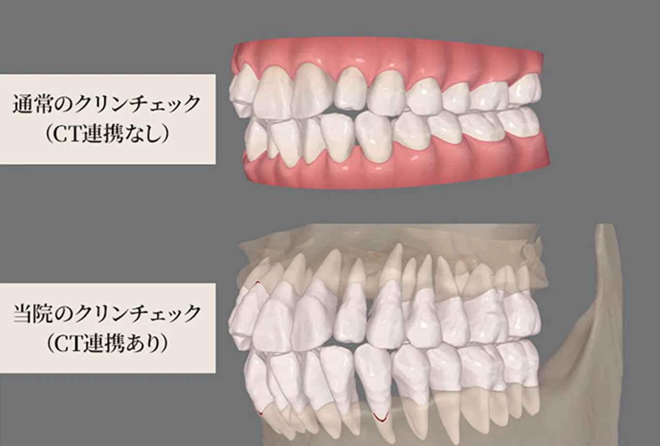 抜歯や外科手術が必要な症例もご相談ください